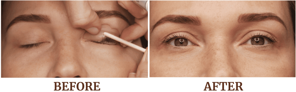 Eyelash Lift Before & After Picture