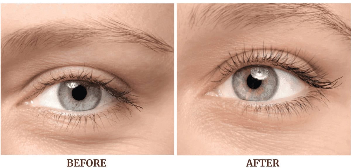 Eyelash Perm Before & After Picture
