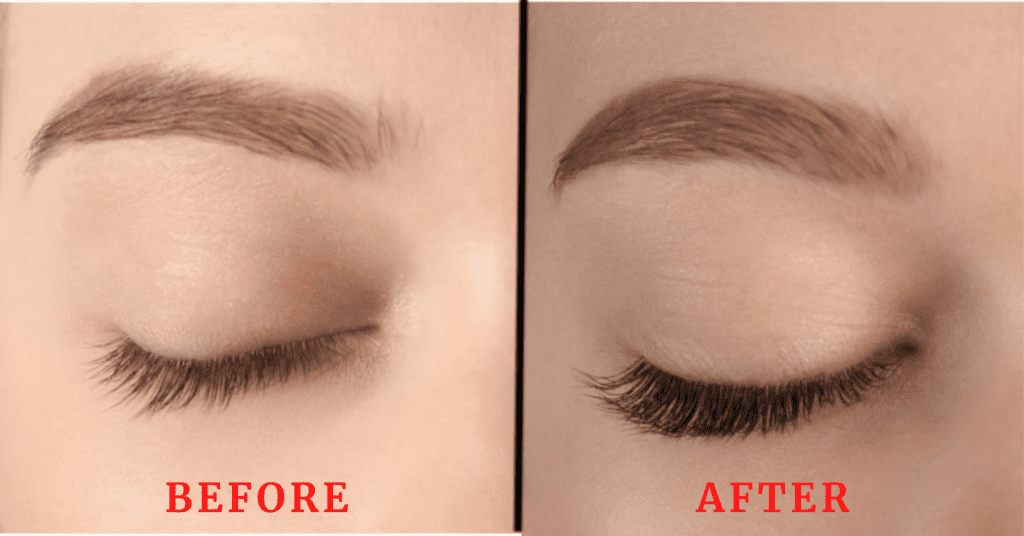 Eyelash serum before & after Picture